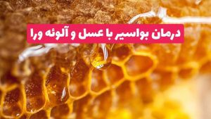 درمان بواسیر با عسل