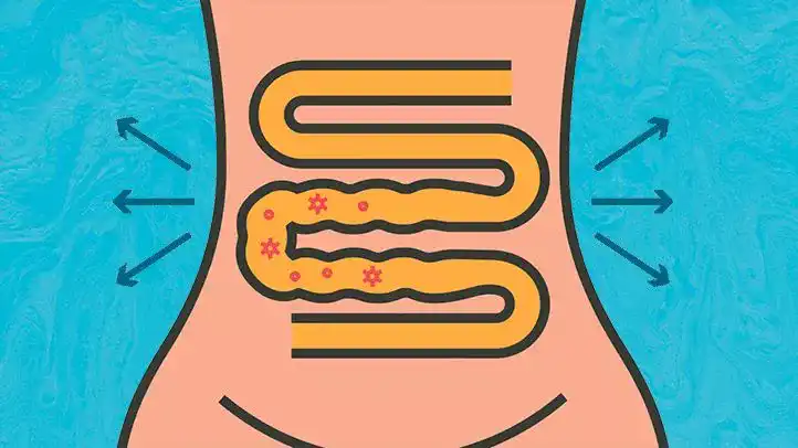 درمان اسهال