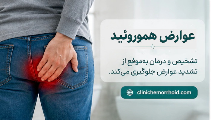 عوارض هموروئید و درد و التهاب ناشی از بواسیر