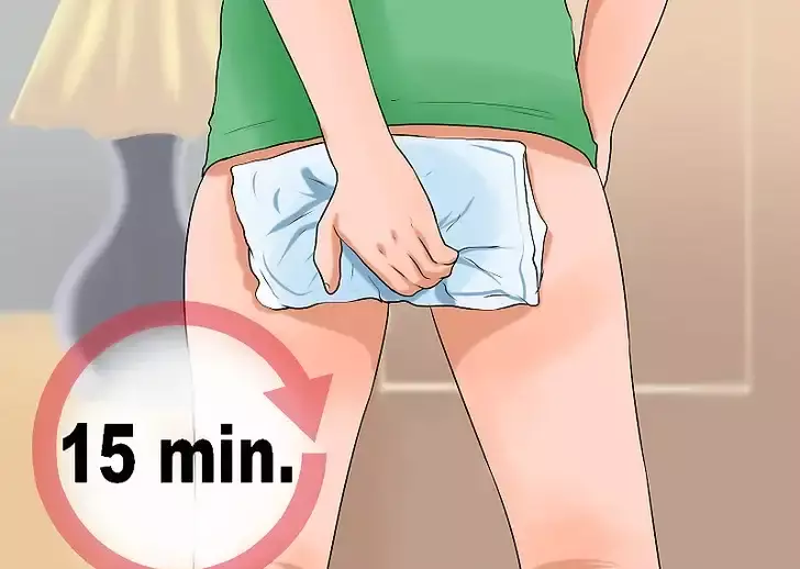 خارش بواسیر