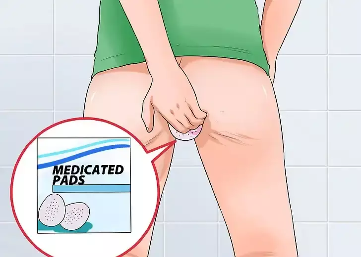 خارش بواسیر