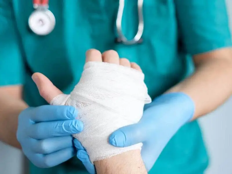 بیماری فیستول چیست