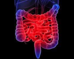 روده ناسالم