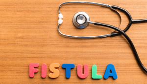 مراحل درمان فیستول با لیزر