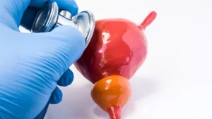 آیا فیستول خطرناک است؟