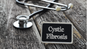 روش های درمان کیست مویی چیست؟