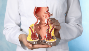 شقاق مقعدی چیست؟