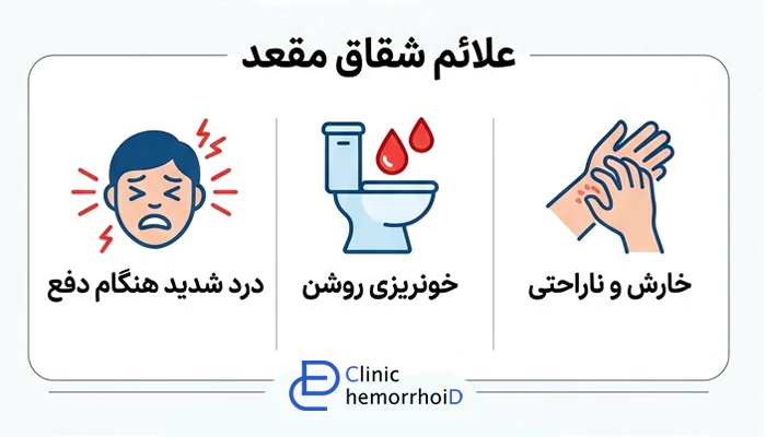 علائم شقاق مقعدی