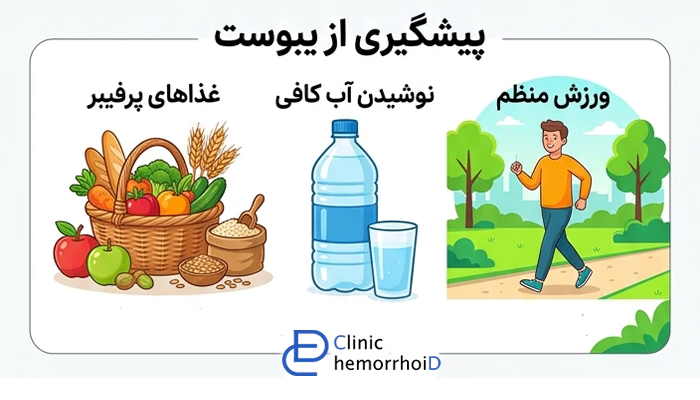 پیشگیری از شقاق مقعدی