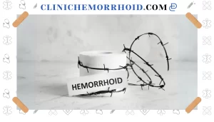 10 راهکار مهم برای پیشگیری از ابتلا به هموروئید