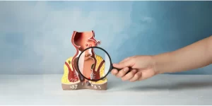 هموروئید چیست؟