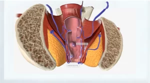 پاتوبیولوژیک هموروئید