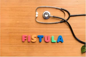 فیستول چگونه به وجود می آید؟
