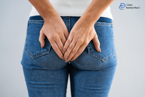 شقاق و انواع آن