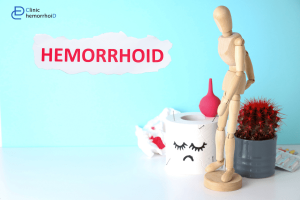 اقدامات درمانی بعد از لیزر هموروئید