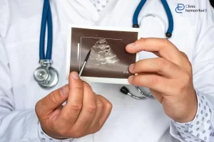 کیست مویی در ورزشکاران: پیشگیری و درمان در افراد فعال