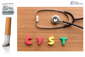 رابطه آشکار و پنهان ترک سیگار بر کیست مویی