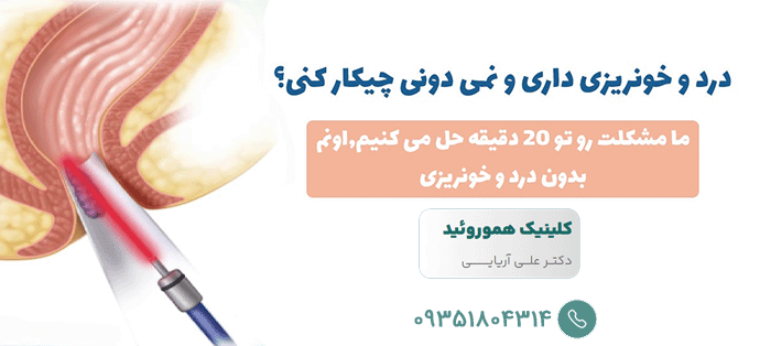 لیزر بواسیر در کلینیک هموروئید