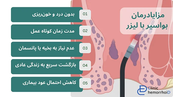 مزایا لیزر بواسیر