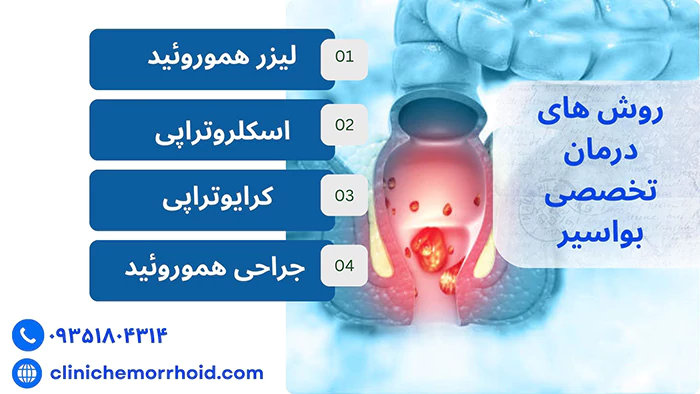 روش درمان بواسیر