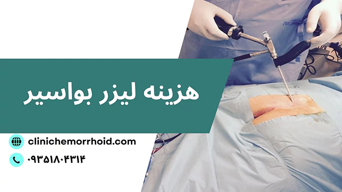هزینه لیزر بواسیر
