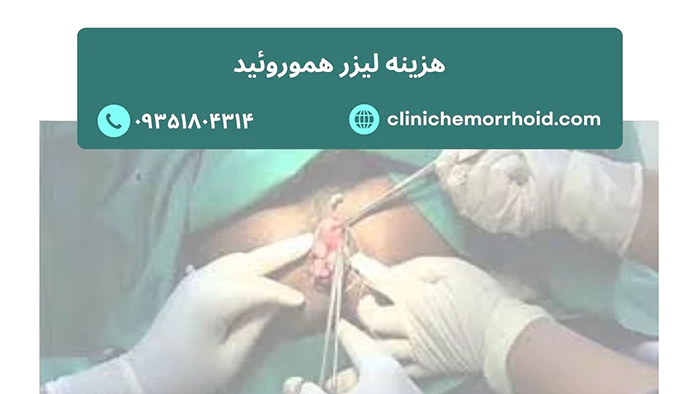 هزینه لیزر هموروئید چقدره؟