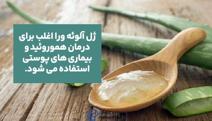 درمان بواسیر با آلوئورا