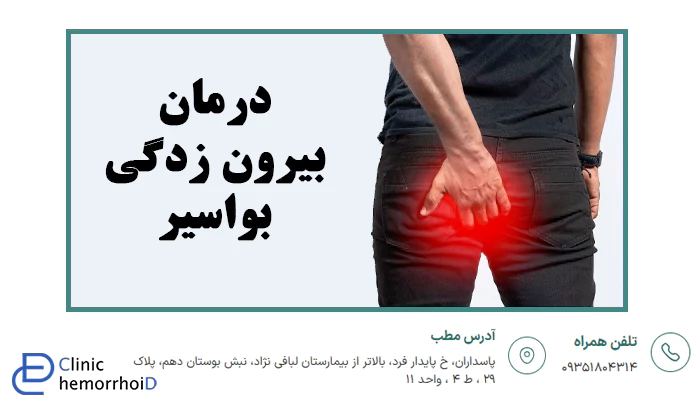 درمان بیرون زدگی بواسیر